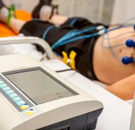 ECG